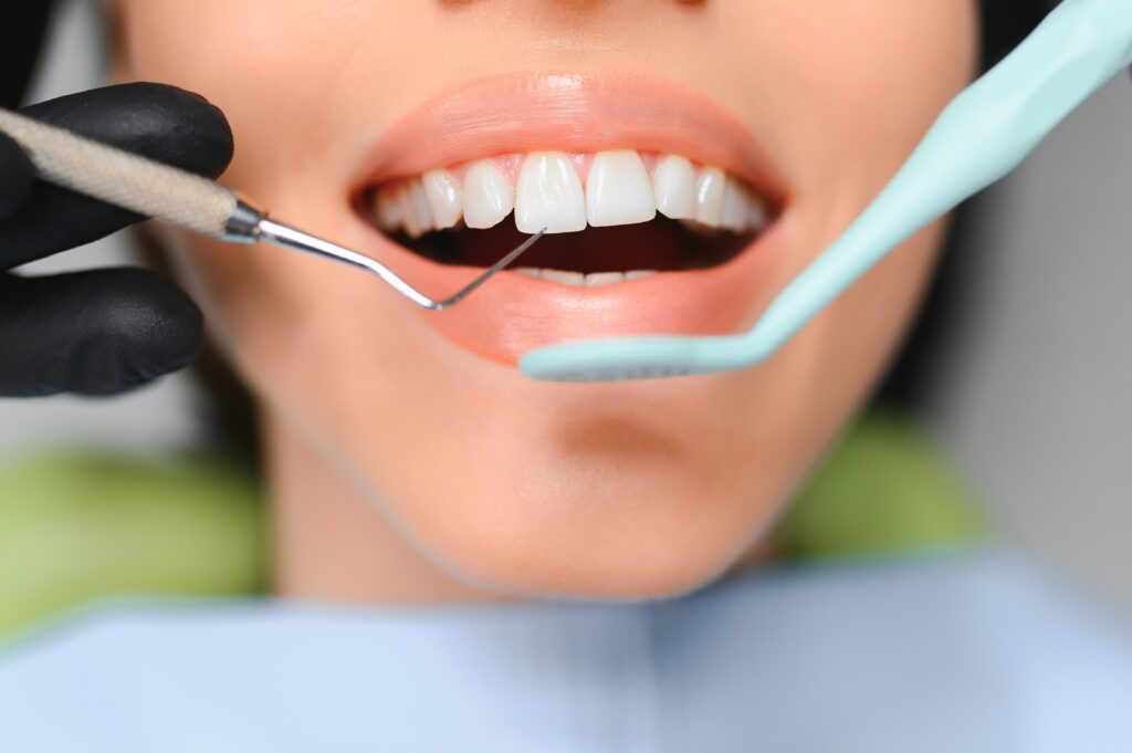 lake orion periodontal cleaning