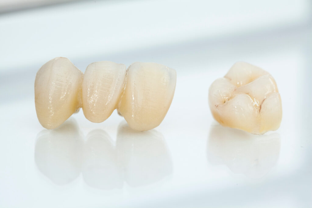 lake orion cerec crowns