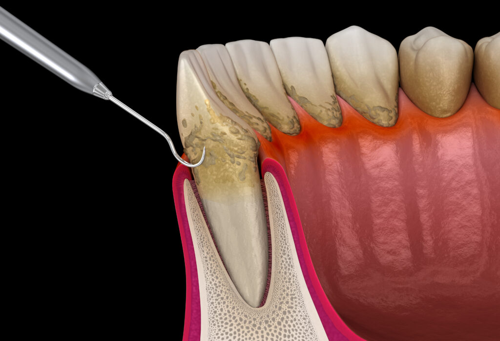 lake orion periodontal services