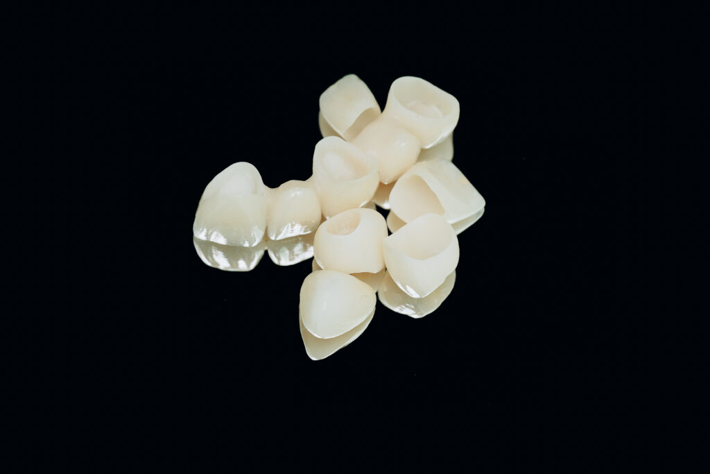 lake orion same-day crowns