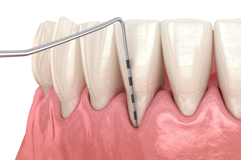 lake orion periodontal cleaning