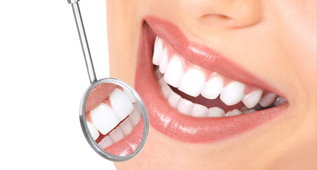 lake orion teeth whitening