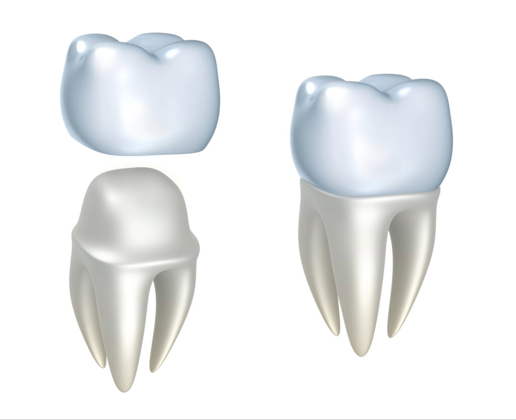 lake orion advanced dentistry