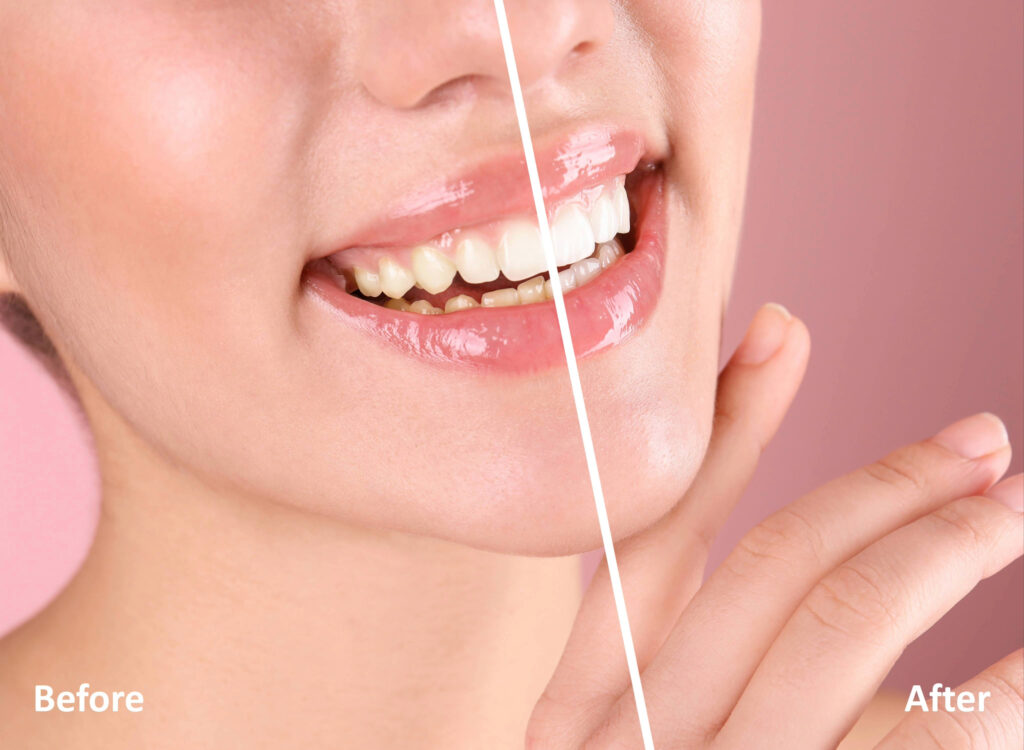 lake orion cosmetic dentistry
