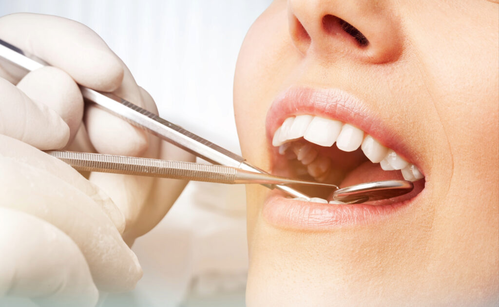 lake orion metal-free dental work